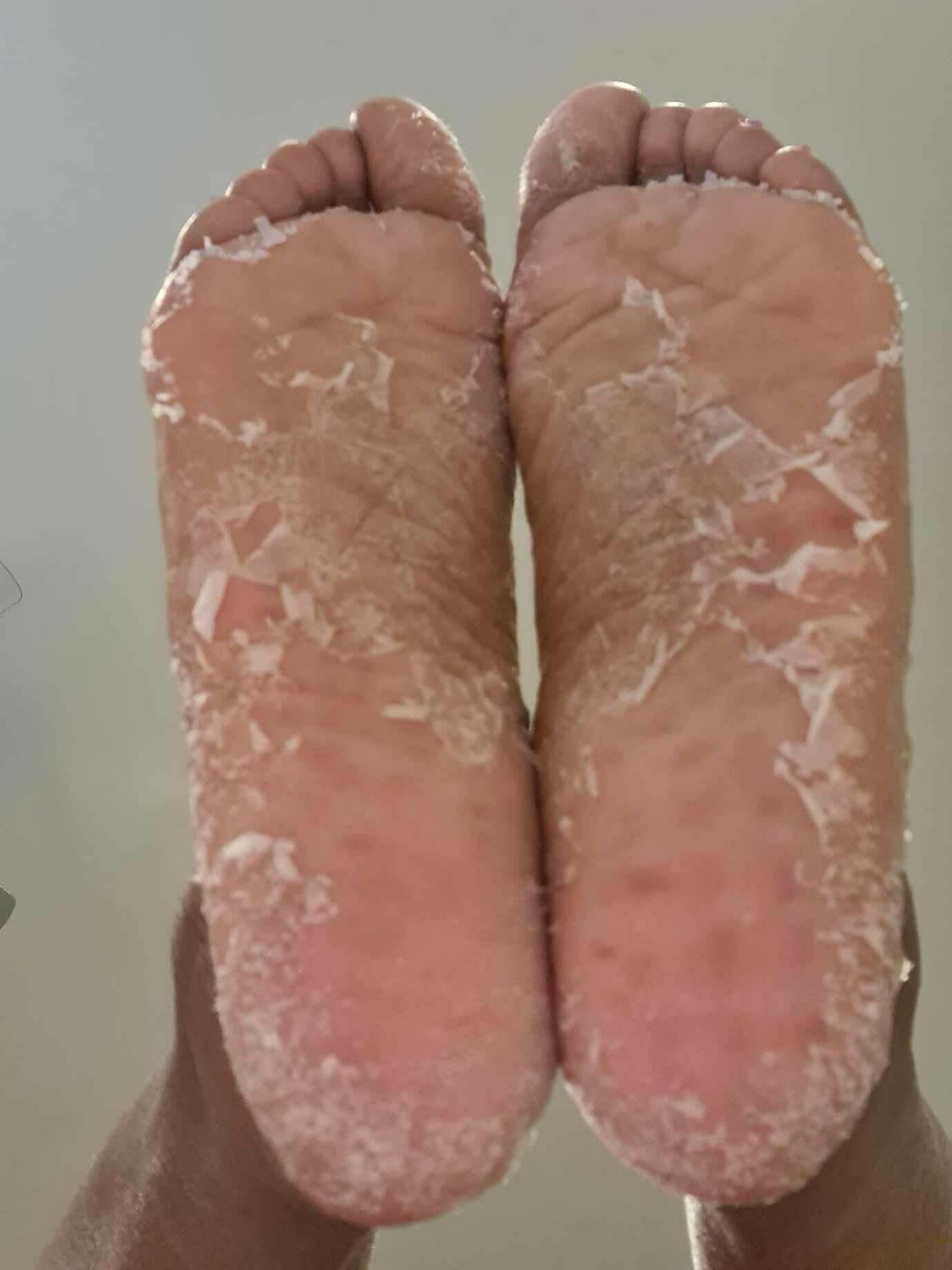 Foot Peel by Luxury DIY Body Spa